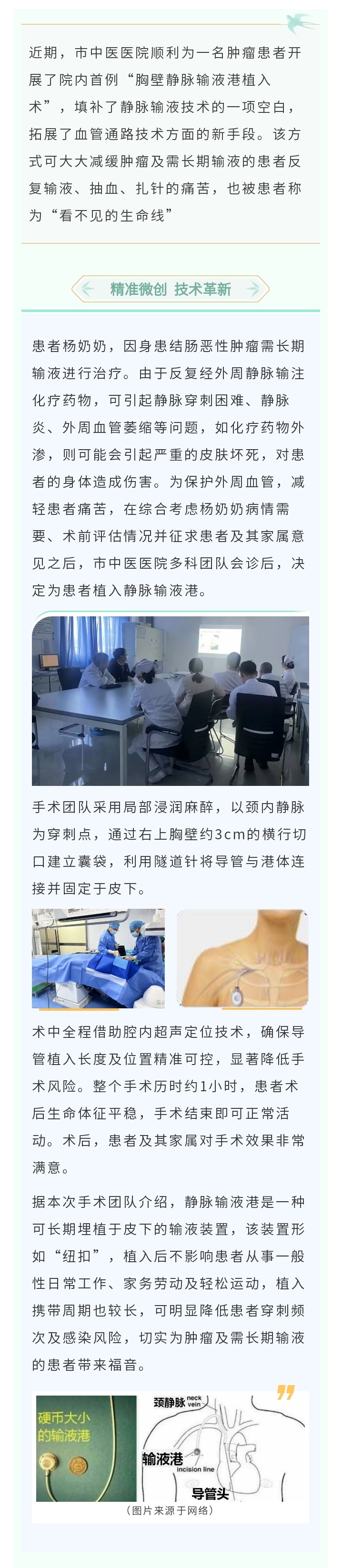 市中医医院为肿瘤患者开展“胸壁静脉输液港植入术” - 副本.jpg